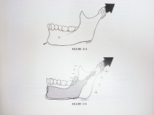 mandibular growth