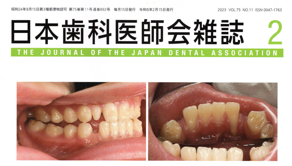 インビザライン失敗例