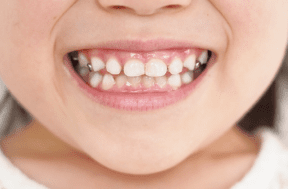 子どもの口アップ