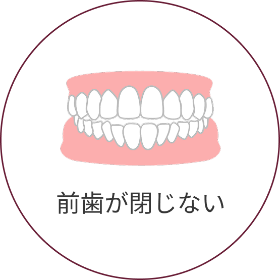 開咬（かいこう）