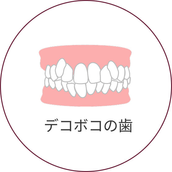 叢生（そうせい）