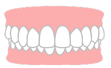 噛み合わせが深い
