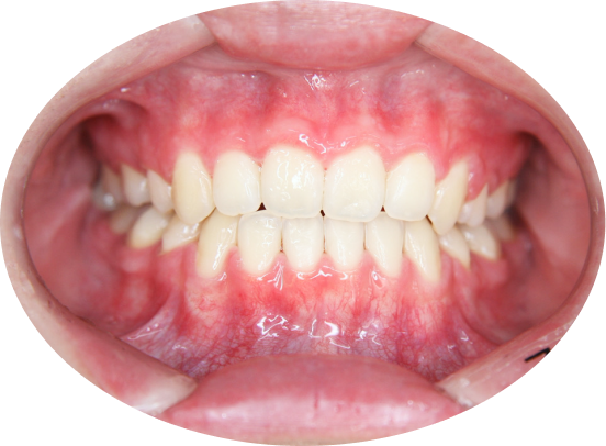 矯正治療の実績