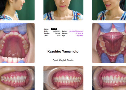 Hello world!= 読者のみなさま！矯正歯科鎌倉 dentofacoです