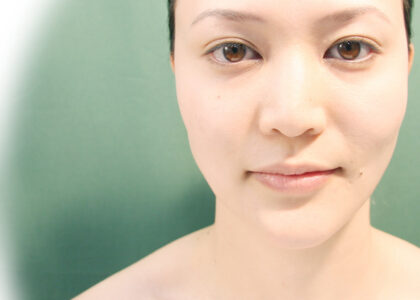 「非抜歯で矯正するということは歯列を拡大すること！」