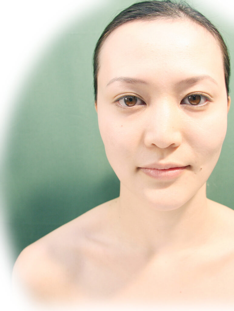 「非抜歯で矯正するということは歯列を拡大すること！」