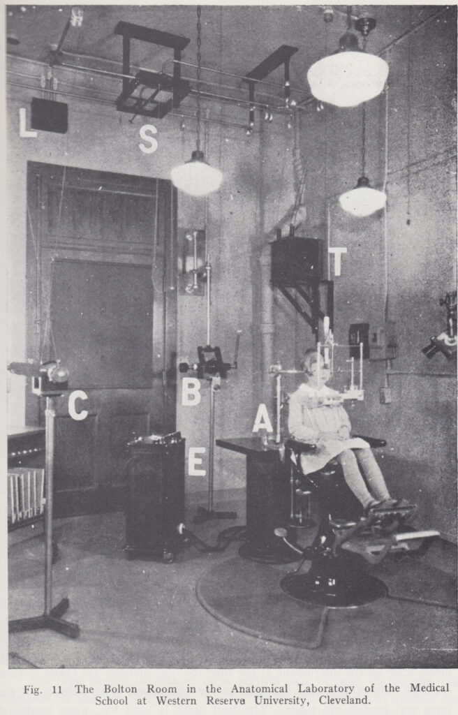 矯正診断に必須のセファロは150cm離れたところから撮影する規格写真です