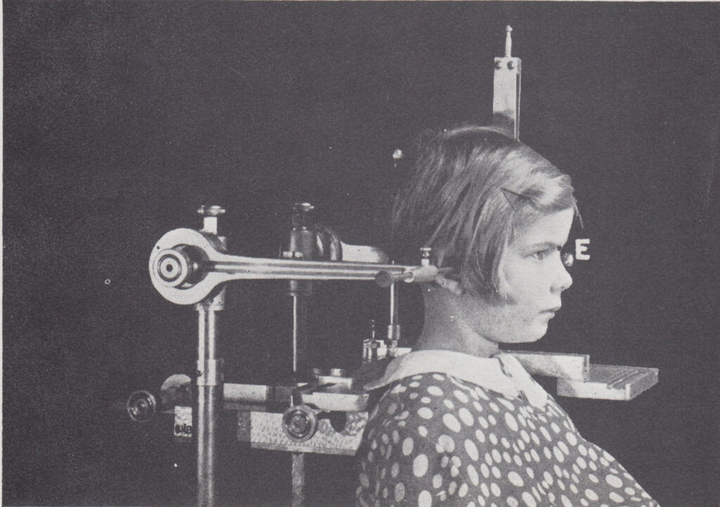 1. セファロって何？ (矯正歯科の専門性の証)