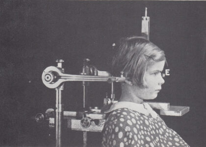 1. セファロって何？ (矯正歯科の専門性の証)