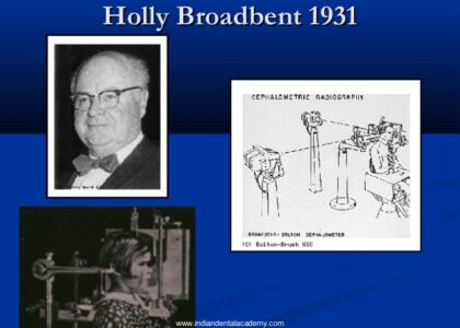 ２．セファロの歴史