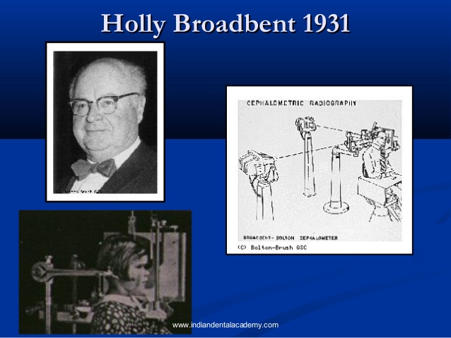 矯正治療のほんと5）矯正診断におけるセファロの重要性