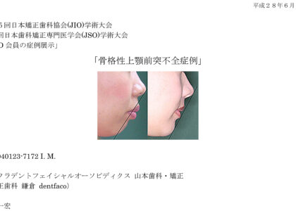 ３．セファロの目的  B) 矯正治療前後の比較による矯正治療効果の判定(矯正治療に治療計画上の抜歯は必要か？)