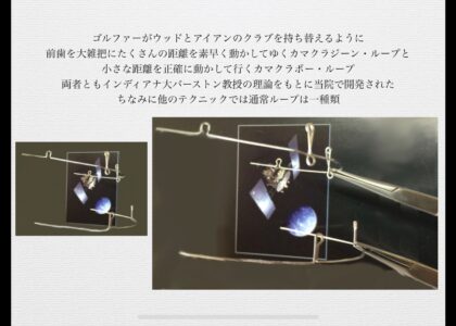 矯正歯科専門医が行うセグメンテッド・アーチ・テクニック