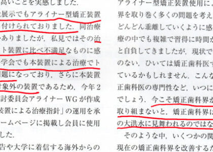 インビザラインやめたほうがいい１０の理由= 一矯正歯科専門医の意見7)日本矯正歯科学会学会長が学会ニューズレターで “明らかにワイヤー矯正に比べ治療結果が劣る”・・・と表明