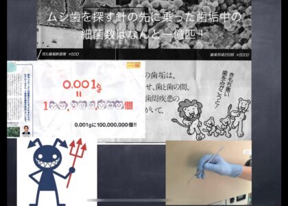 biofilm= バイオフィルム=歯垢中細菌数は約１億/0.001g＝大便の２倍も汚いんです！