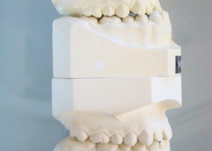 矯正歯科専門医が行う医療である矯正治療対3Dプリンタでこしらえた食えない饅頭=マウスピース矯正