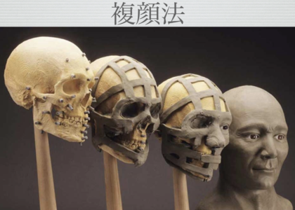 「ひとはまだ本当の矯正治療を知らない！＝矯正歯科鎌倉 dentofacoで矯正歯科専門医による価値ある本当の矯正治療で改善可能な点7) 顔形がキレイになる＝美容的意義」