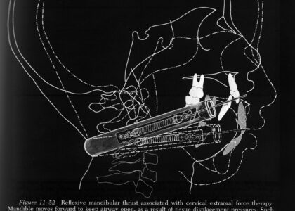 「ひとはまだ本当の矯正治療を知らない！＝矯正歯科鎌倉 dentofacoで矯正歯科専門医による価値ある本当の矯正治療で改善可能な点9) 姿勢が良くなる＝整形外科的意義」