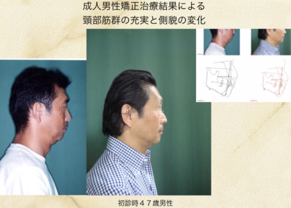 13) 矯正歯科専門医による矯正治療で老化が遅くなる＝アンチエイジング的意義