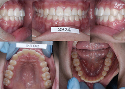 11) 矯正歯科専門医による矯正治療で背が高くなり体格が良くなる＝体育的意義