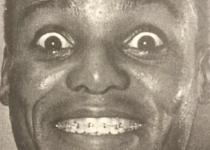 ひとはまだ本当の矯正治療を知らない！＝矯正歯科鎌倉dentofaco 矯正歯科医による価値ある本当の矯正治療で改善可能な点21) 運動機能がよくなる