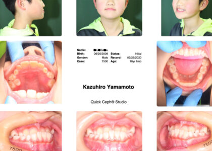 ４-1．初診も通っていないのに短期間で治る？