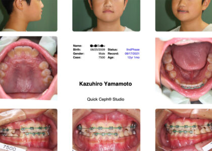 ４-２．初診も通っていないのに短期間で治る？