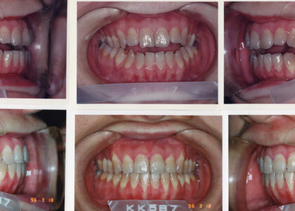 初診も通っていないのに簡単に治る？