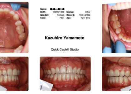 最近テレビで芸能人口デカイ人増えてません？