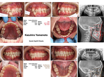 安心安全な矯正治療をうけるためには日本矯正歯科学会ウェブサイトに掲載の日本歯科専門医機構の名簿にオンリストされている矯正歯科専門医を受診すべき！・・・矯正歯科専門医からの警鐘