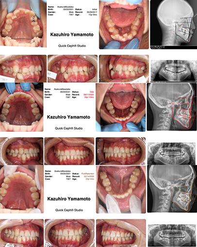 安心安全な矯正治療をうけるためには日本矯正歯科学会ウェブサイトに掲載の日本歯科専門医機構の名簿にオンリストされている矯正歯科専門医を受診すべき！・・・矯正歯科専門医からの警鐘