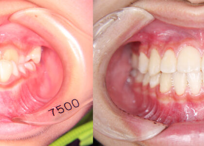 “矯正治療はアートである??”