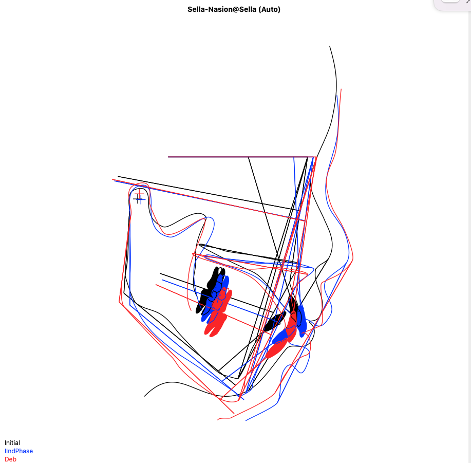 それでは矯正歯科専門医と一般歯科医の小児矯正治療のどこが違うのでしょうか？