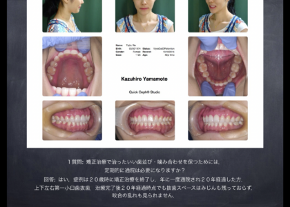 厚労省から法的認定を受けている「日本歯科専門医機構専門医」と「歯科・矯正歯科」を徹底的に比べて見ようか？