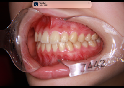 あなたは機構認定矯正歯科専門医を知ってますか？