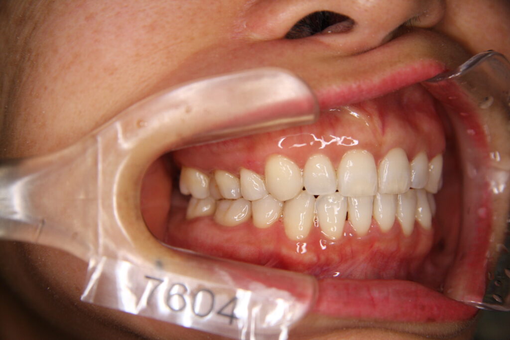 矯正治療が上手くいっていないと感じている方々へ