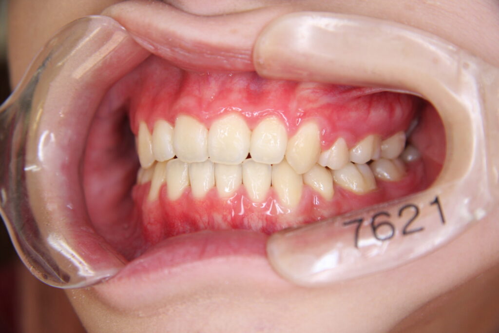 国家資格である日本歯科専門医機構認定矯正歯科専門医が責任を持ってあなたの心身の健康の維持を司らせていただきます