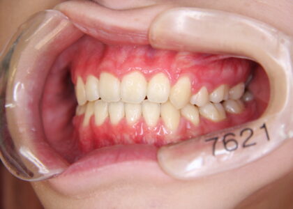 国家資格である日本歯科専門医機構認定矯正歯科専門医が責任を持ってあなたの心身の健康の維持を司らせていただきます