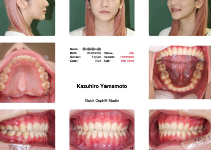 先日フィニッシュした barbiecore なKA さま