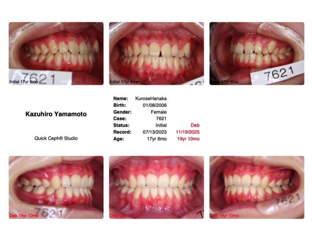  矯正歯科専門医まだあまり知られていないようですが医療において最も大切なことは安心と安全を買うということ